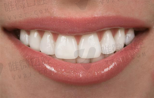 不带假牙和戴上假牙的区别,有没有不带金属挂钩的假牙(图1)